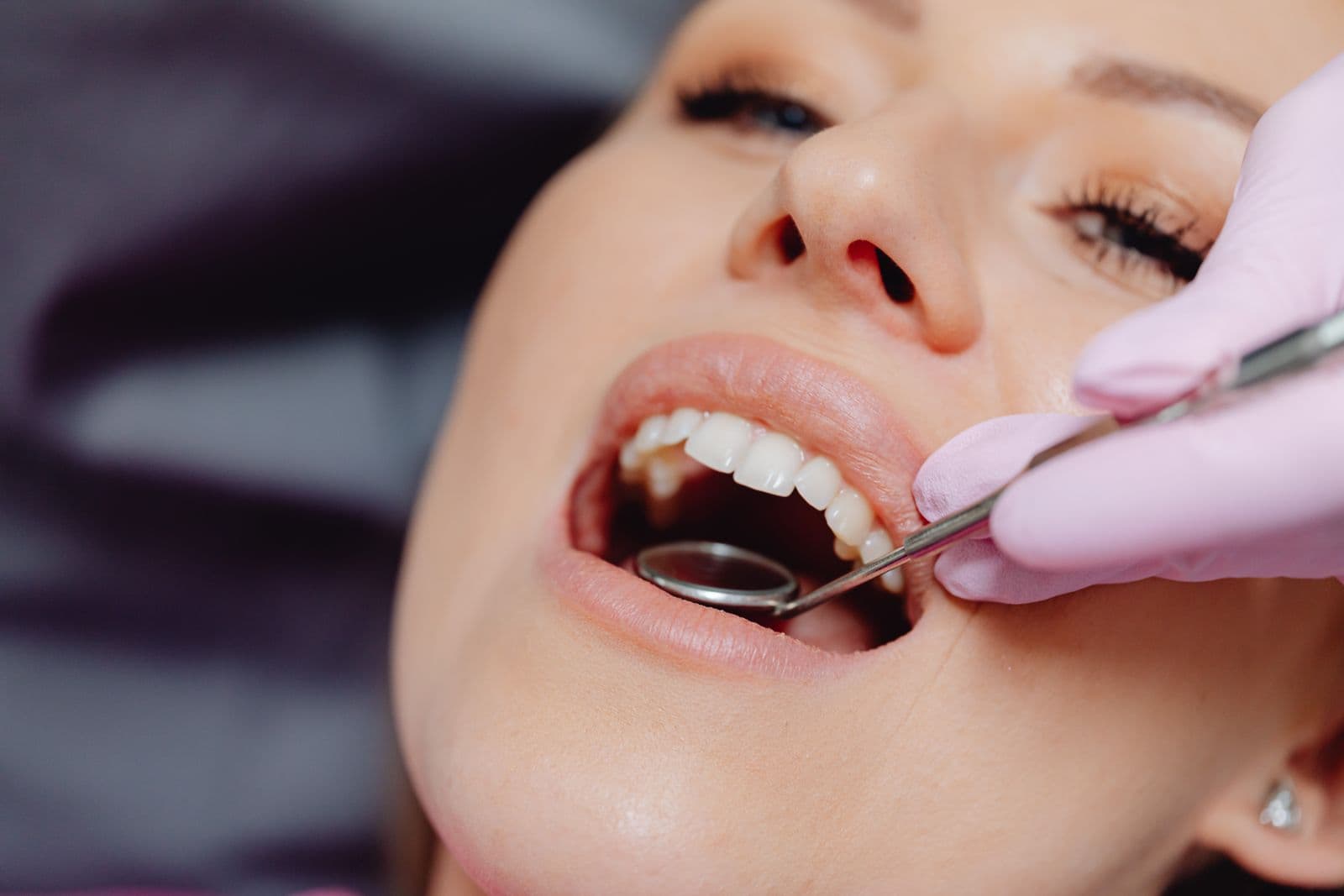 What is periodontal disease?