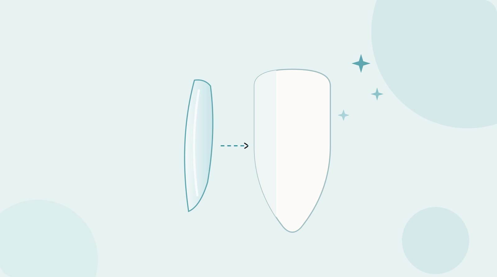 What are dental veneers?