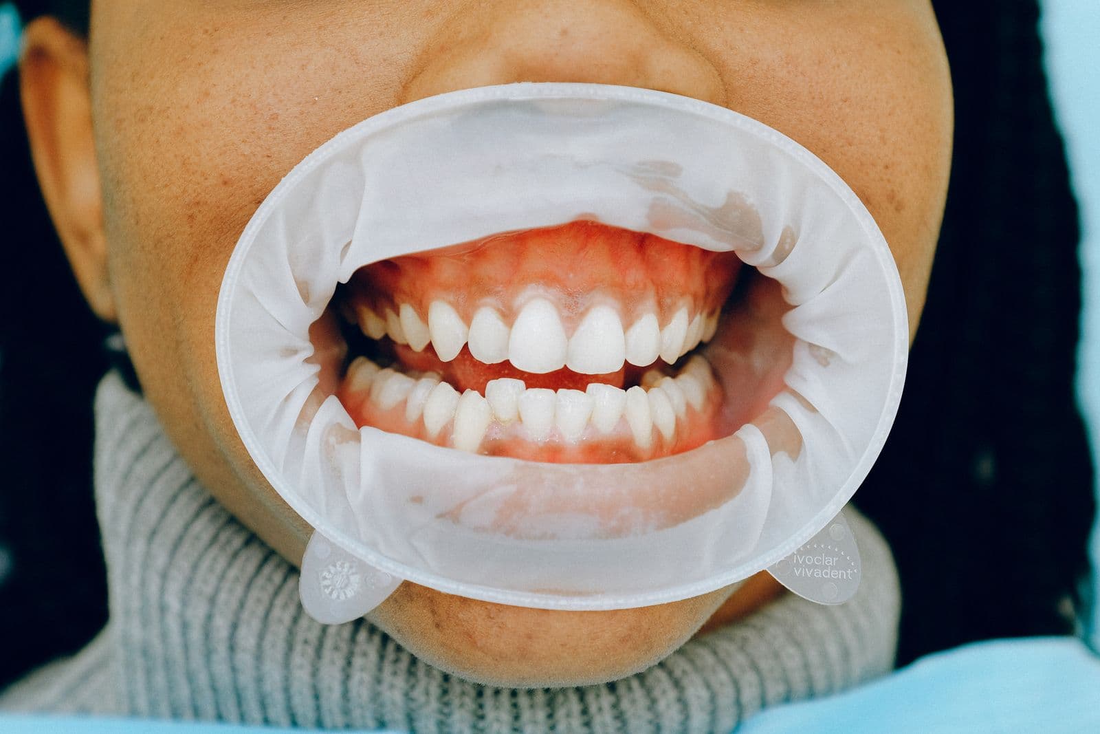 How does a healthy gums looks like?