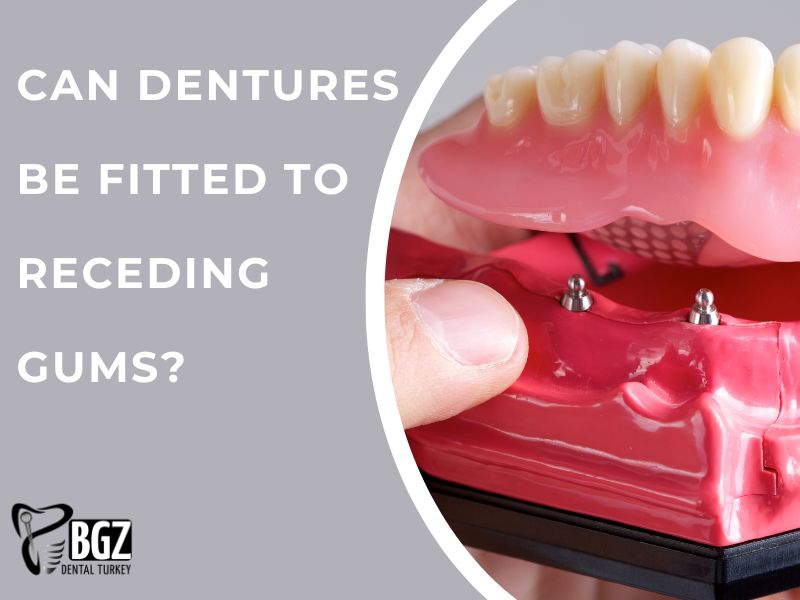 Can Dentures be Fitted to Receding Gums?