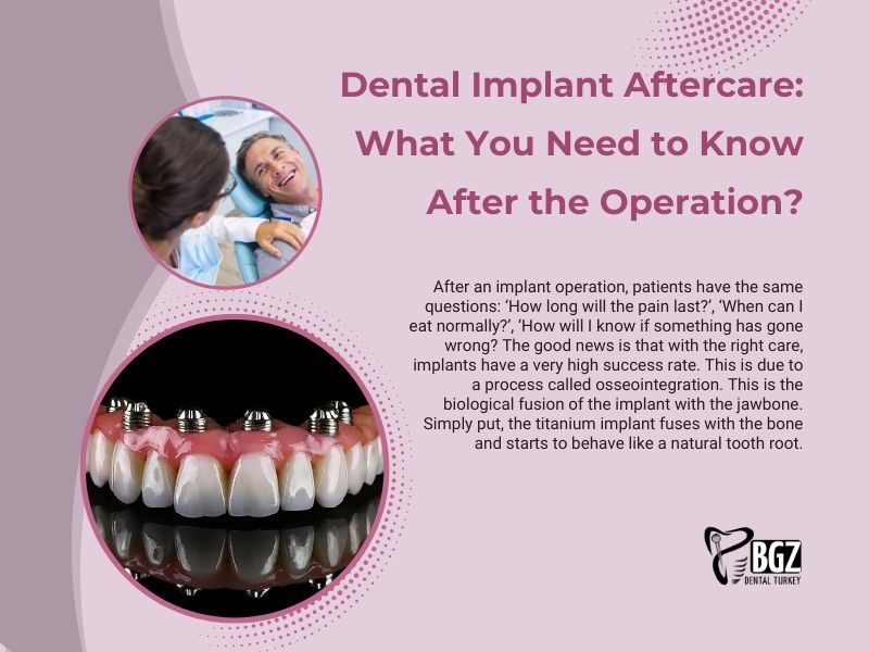 Dental Implant Aftercare