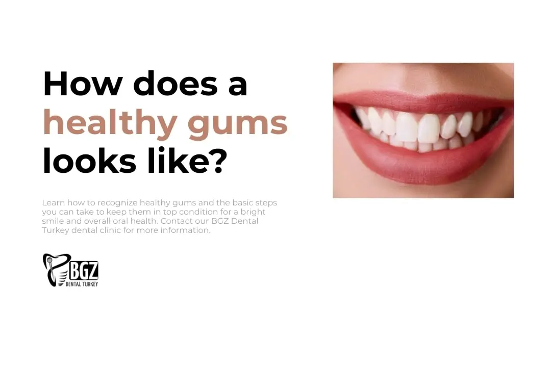 How does a Healthy Gums looks like?