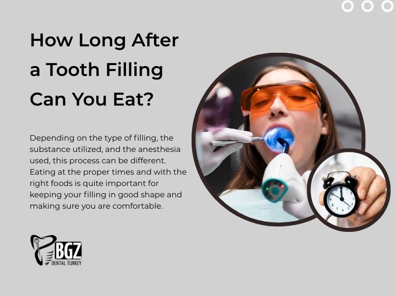 How Long After a Tooth Filling Can You Eat?