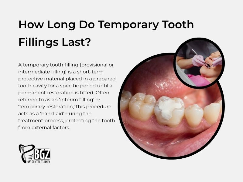 How long do temporary tooth fillings last?
