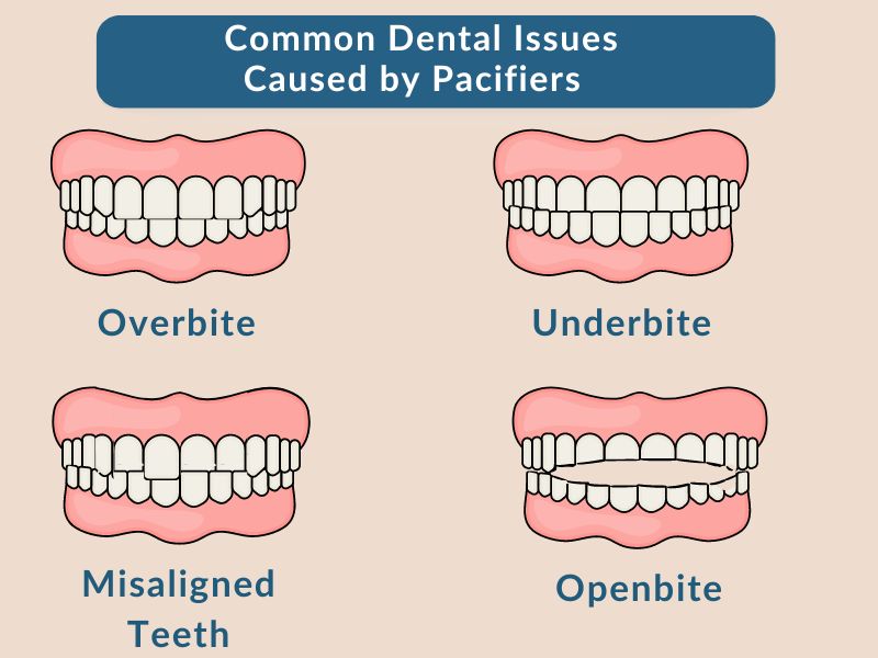 Common Dental Issues Caused by Pacifiers