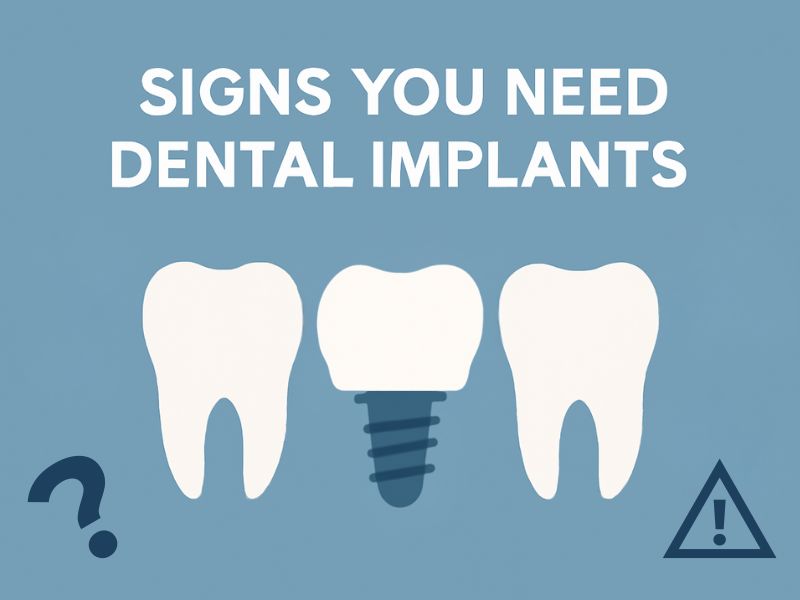 13 Signs You Need Dental Implants for a Healthier Smile