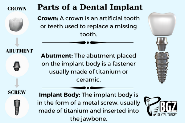 part-of-dental-implant