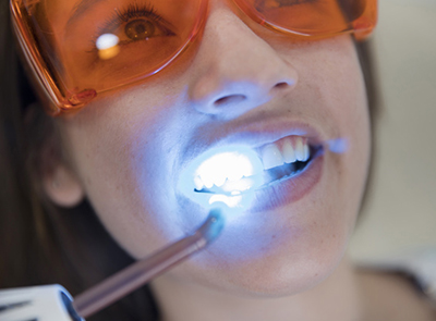 laser-dentistry clinic antalya